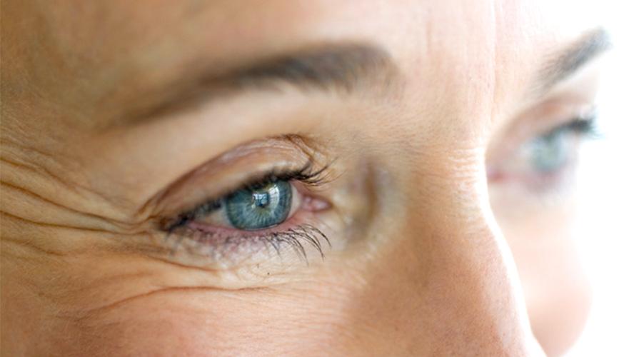 Crows-Feet-Treatment | Tijeras Hair Co. Award-Winning Hair Salon Blog Post